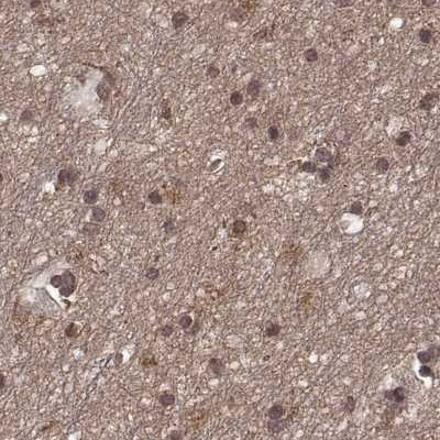 GSS Antibody in Immunohistochemistry (IHC)