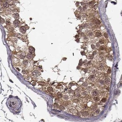 GSS Antibody in Immunohistochemistry (IHC)