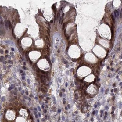 GSS Antibody in Immunohistochemistry (IHC)