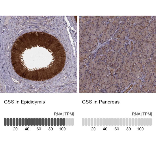 GSS Antibody