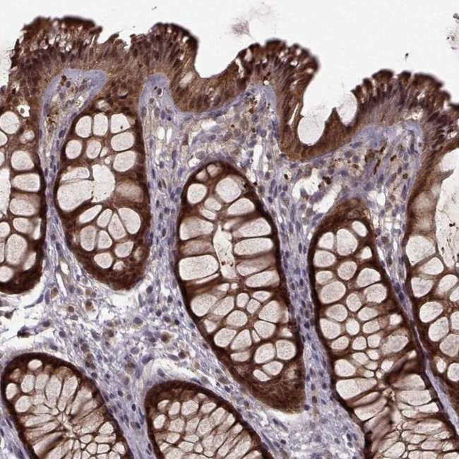 GSS Antibody in Immunohistochemistry (IHC)