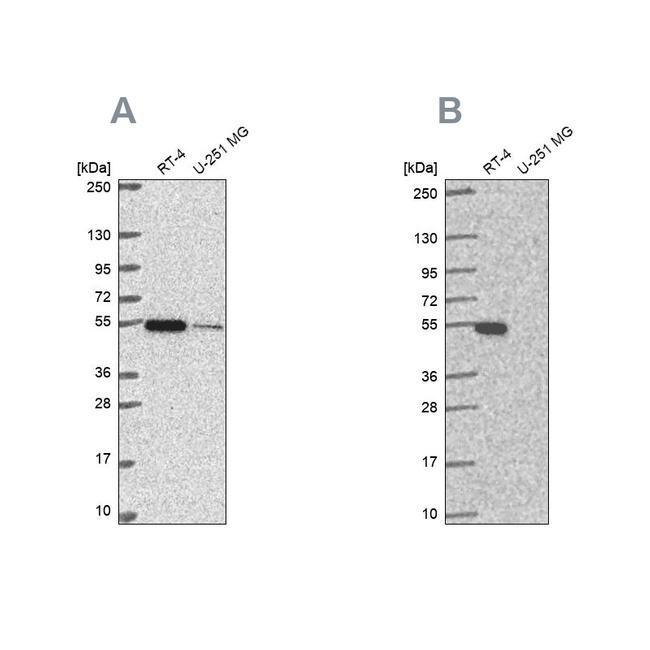 GSS Antibody in Western Blot (WB)