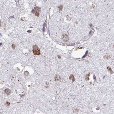 RPS15 Antibody in Immunohistochemistry (IHC)