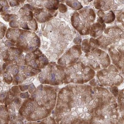 RPS15 Antibody in Immunohistochemistry (IHC)