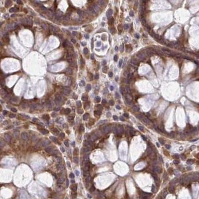 RPS15 Antibody in Immunohistochemistry (IHC)