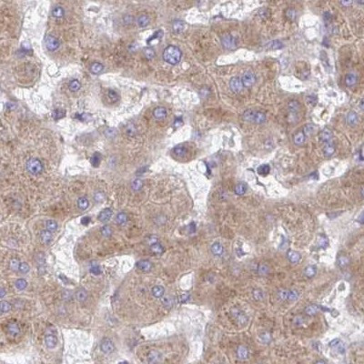 RPS15 Antibody in Immunohistochemistry (IHC)