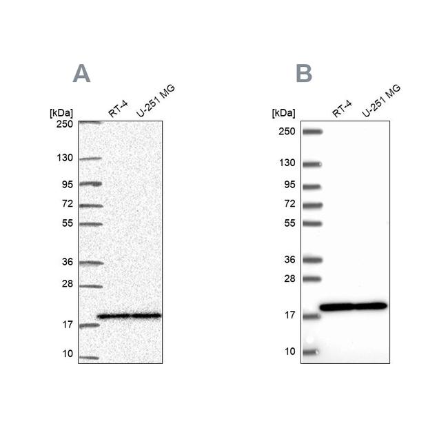 RPS15 Antibody in Western Blot (WB)