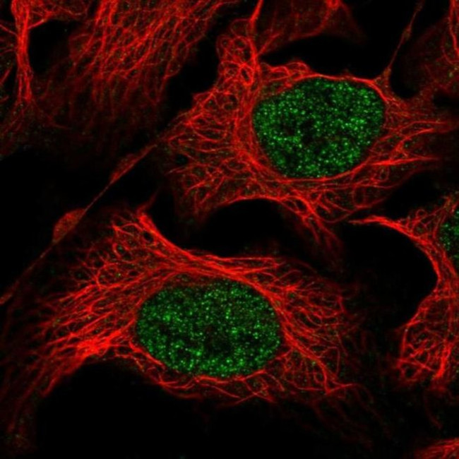 ZSCAN9 Antibody in Immunocytochemistry (ICC/IF)