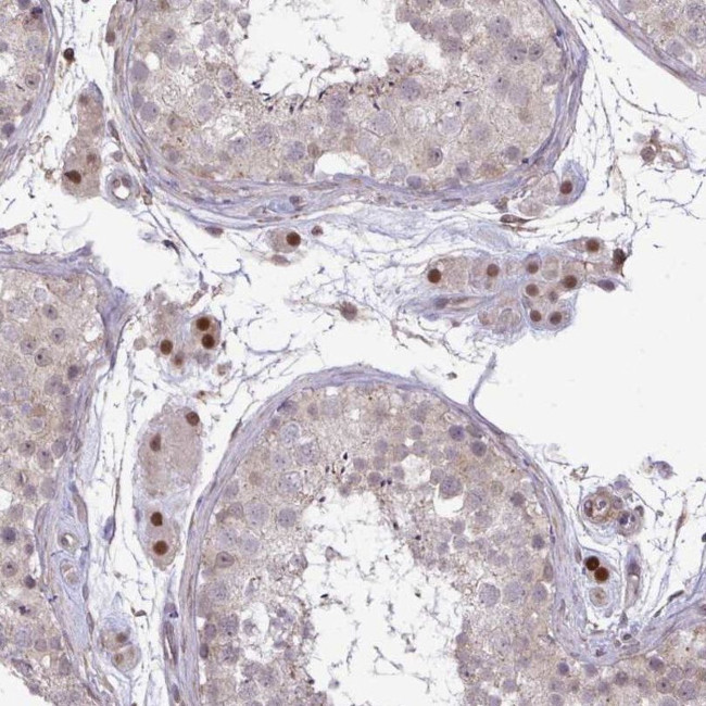 ZSCAN9 Antibody in Immunohistochemistry (IHC)