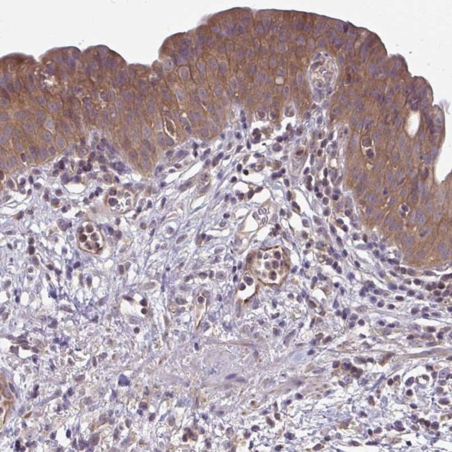 IST1 Antibody in Immunohistochemistry (IHC)