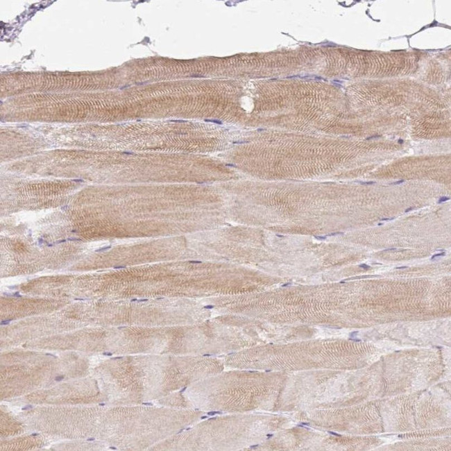 Bestrophin 3 Antibody in Immunohistochemistry (IHC)