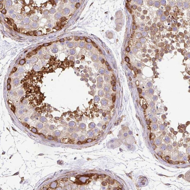 MAP1S Antibody in Immunohistochemistry (IHC)