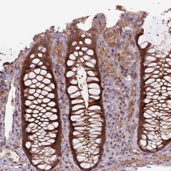 ZSWIM7 Antibody in Immunohistochemistry (IHC)