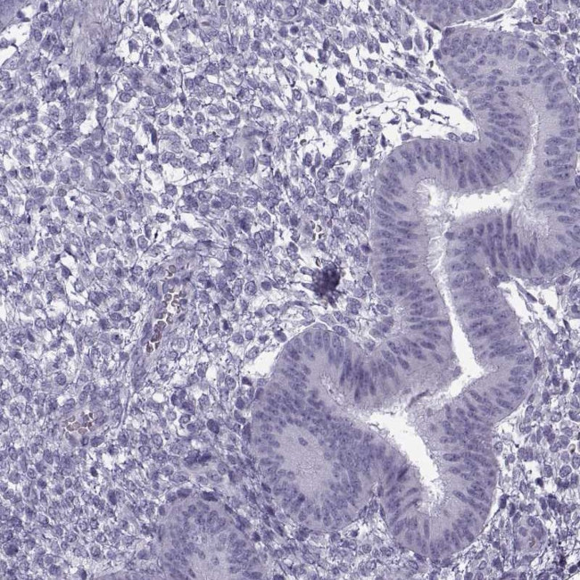 GTSF1L Antibody in Immunohistochemistry (IHC)