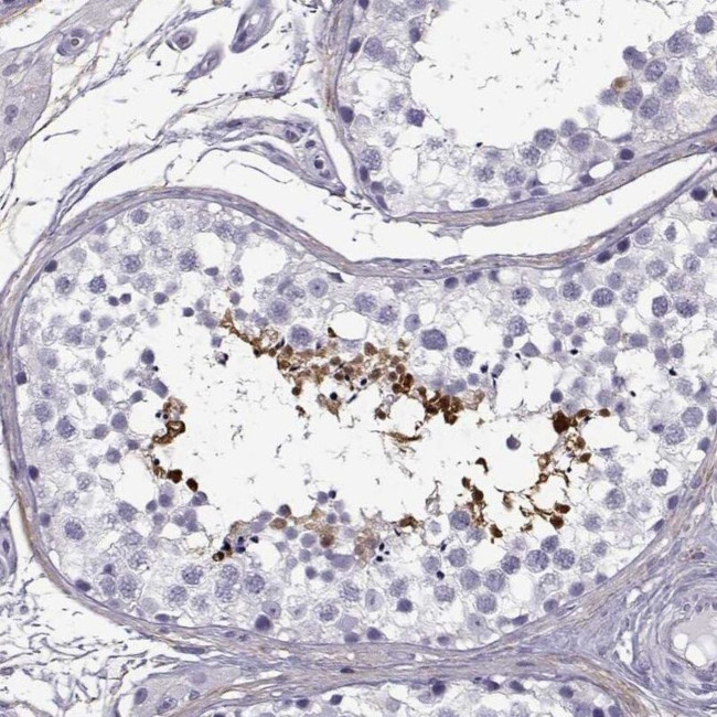 GTSF1L Antibody in Immunohistochemistry (IHC)