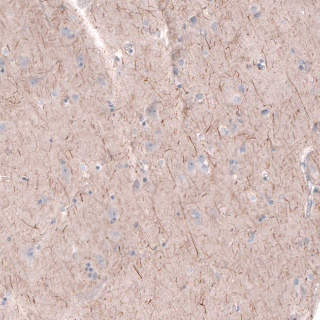 PTPRK Antibody in Immunohistochemistry (IHC)