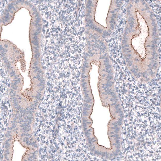 PTPRK Antibody in Immunohistochemistry (IHC)