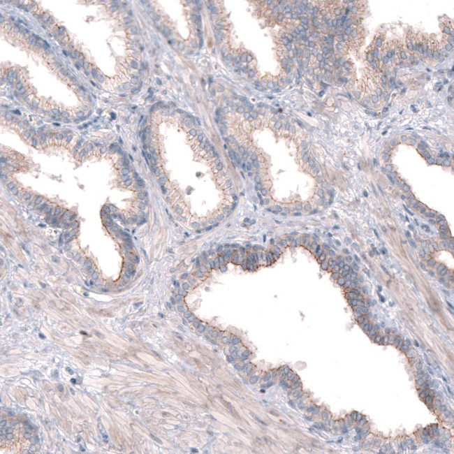 PTPRK Antibody in Immunohistochemistry (IHC)