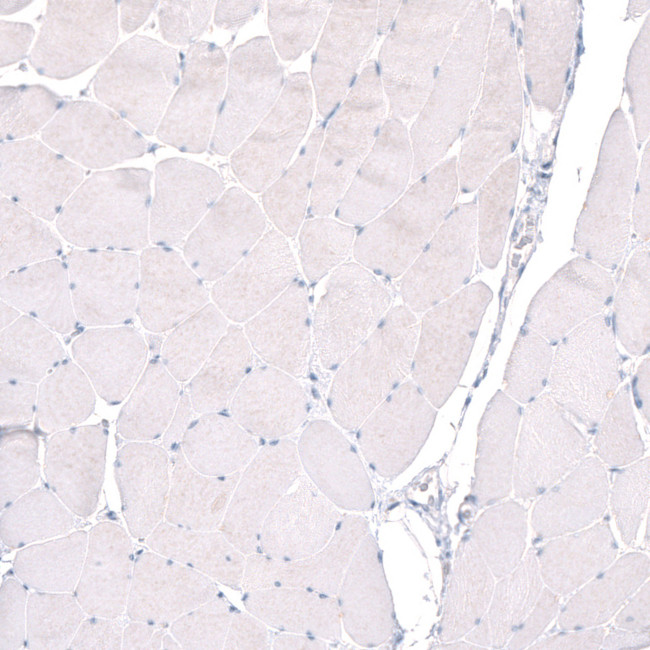 PTPRK Antibody in Immunohistochemistry (IHC)