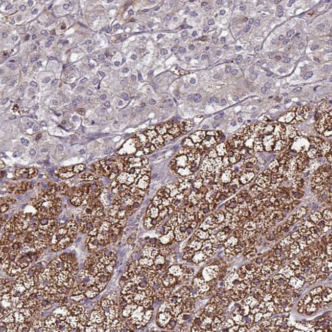 PTPRD Antibody in Immunohistochemistry (IHC)