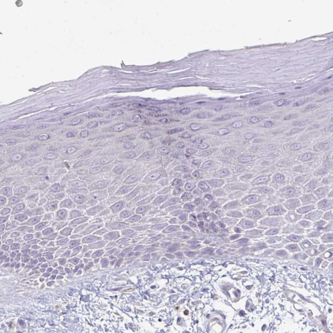 PTPRD Antibody in Immunohistochemistry (IHC)