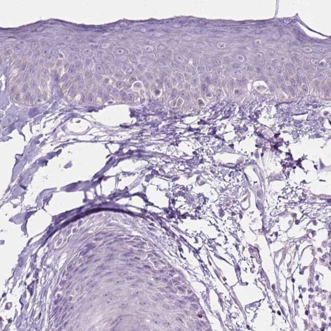 TRIM72 Antibody in Immunohistochemistry (IHC)