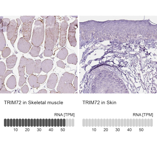 TRIM72 Antibody