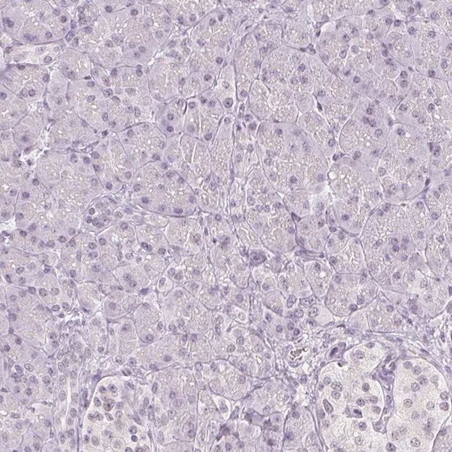 DNAJC6 Antibody in Immunohistochemistry (IHC)