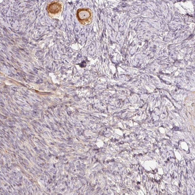 SLC29A3 Antibody in Immunohistochemistry (IHC)