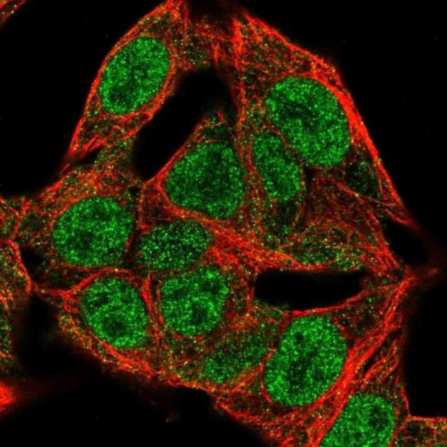 DCAF17 Antibody in Immunocytochemistry (ICC/IF)