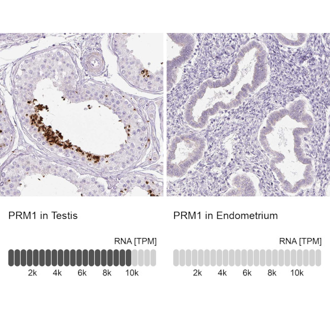 PRM1 Antibody in Immunohistochemistry (IHC)