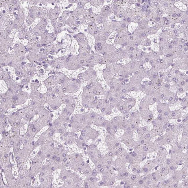 PRM1 Antibody in Immunohistochemistry (IHC)