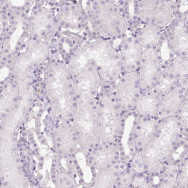 PRM1 Antibody in Immunohistochemistry (IHC)