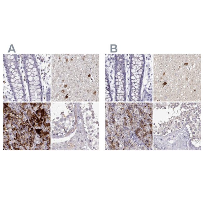 VGF Antibody in Immunohistochemistry (IHC)