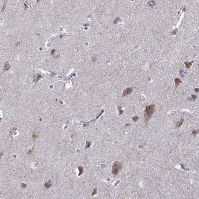 VGF Antibody in Immunohistochemistry (IHC)