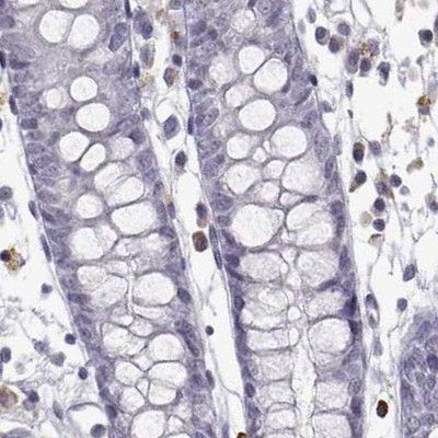 VGF Antibody in Immunohistochemistry (IHC)