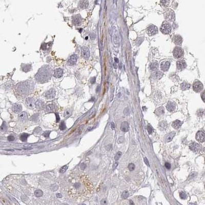 VGF Antibody in Immunohistochemistry (IHC)