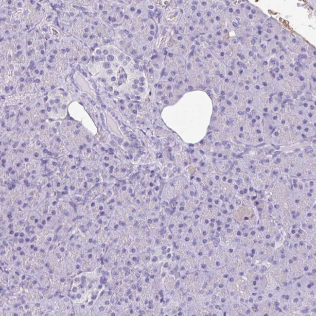 TMEM79 Antibody in Immunohistochemistry (IHC)