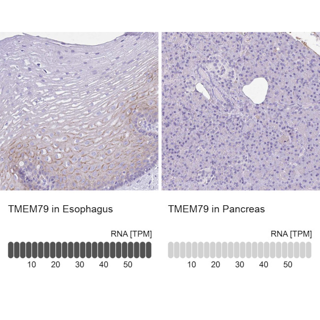 TMEM79 Antibody