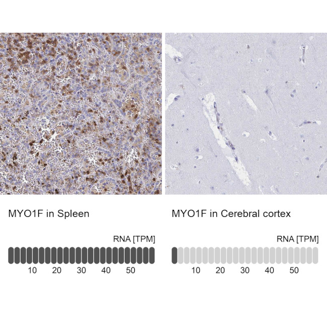 MYO1F Antibody in Immunohistochemistry (IHC)