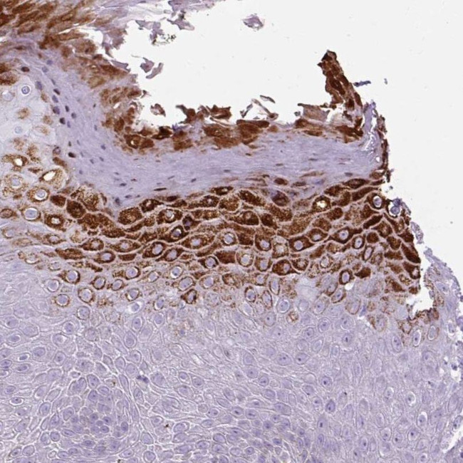 B3GNT4 Antibody in Immunohistochemistry (IHC)