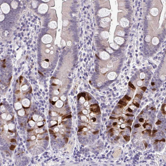 Cdc20 Antibody in Immunohistochemistry (IHC)