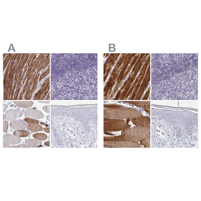 Calsequestrin 2 Antibody in Immunohistochemistry (IHC)