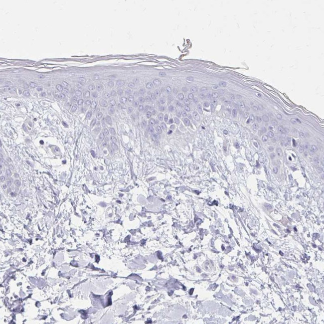 Calsequestrin 2 Antibody in Immunohistochemistry (IHC)