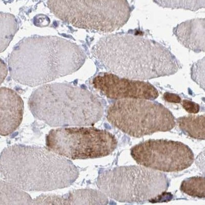 Calsequestrin 2 Antibody in Immunohistochemistry (IHC)