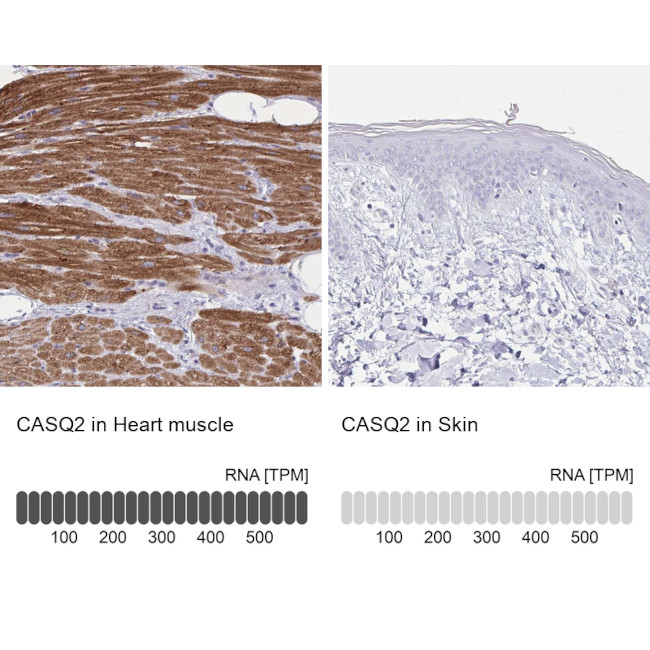 Calsequestrin 2 Antibody