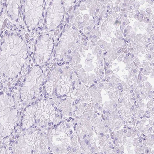 UPP1 Antibody in Immunohistochemistry (IHC)