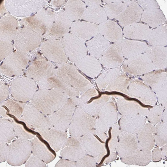 ZW10 Antibody in Immunohistochemistry (IHC)