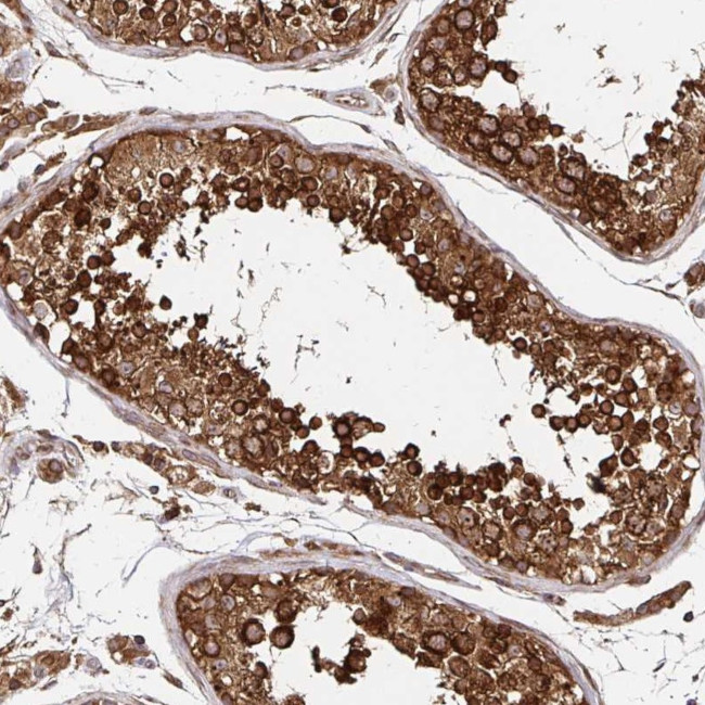 ZW10 Antibody in Immunohistochemistry (IHC)