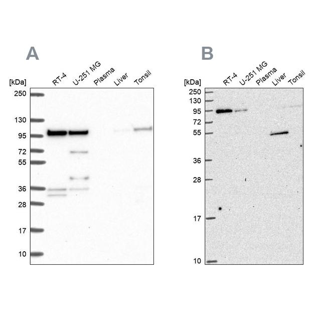 ZW10 Antibody in Western Blot (WB)